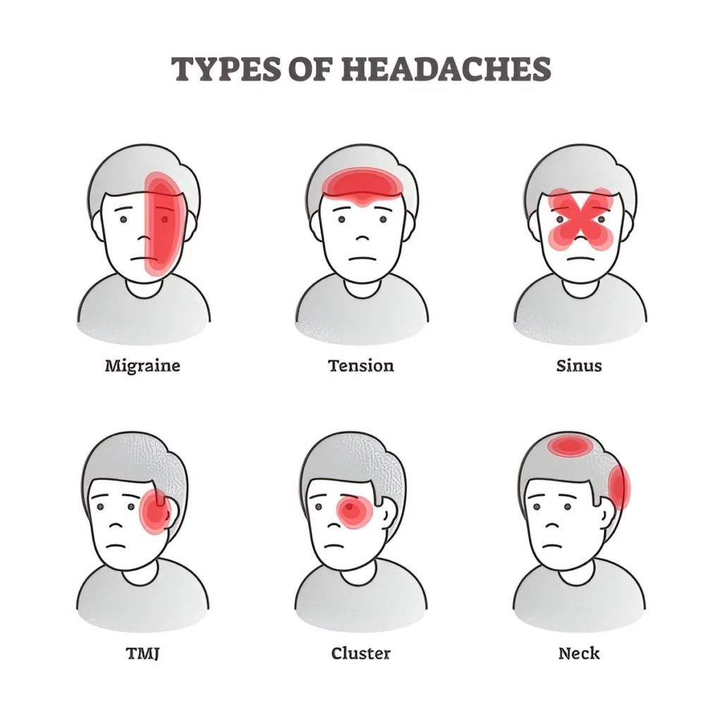 Types of Headache